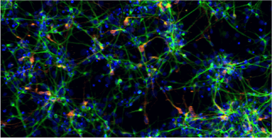 Neurones, excroissance des neurites