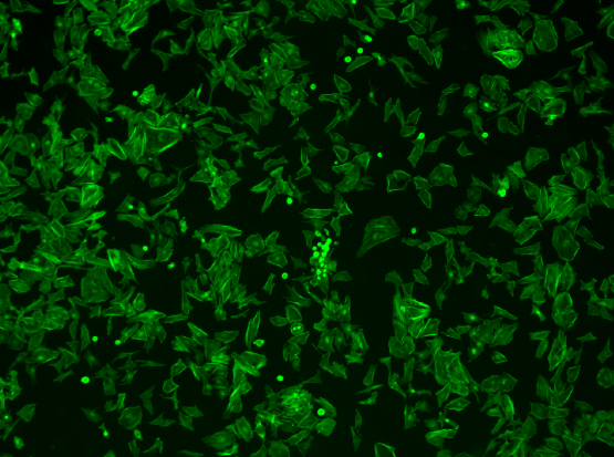 La cytométrie par imagerie, une technique de numération cellulaire