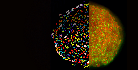 Tests cellulaires 2D et 3D hautement complexes à lumière laser