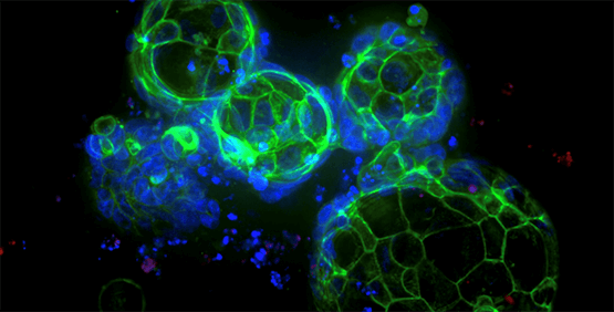 Organoïdes de cancer colorectal