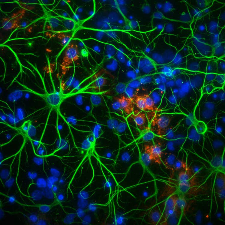 Système d’imagerie haut contenu Micro Confocal