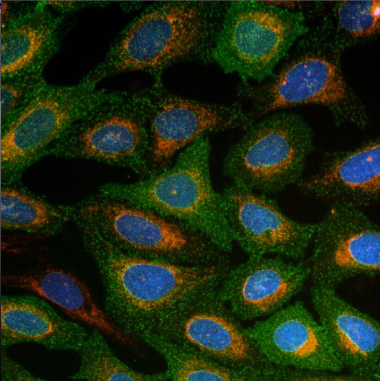 Technologie AgileOptix pour ImageXpress Micro Confocal