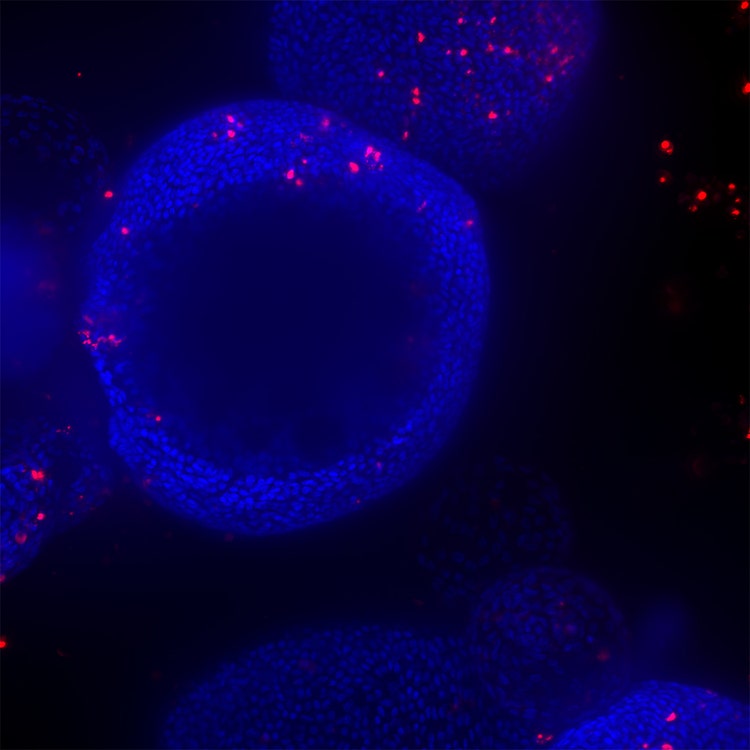Organoïde HT.ai avec trou noir