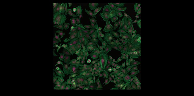 Système d’imagerie cellulaire Pico