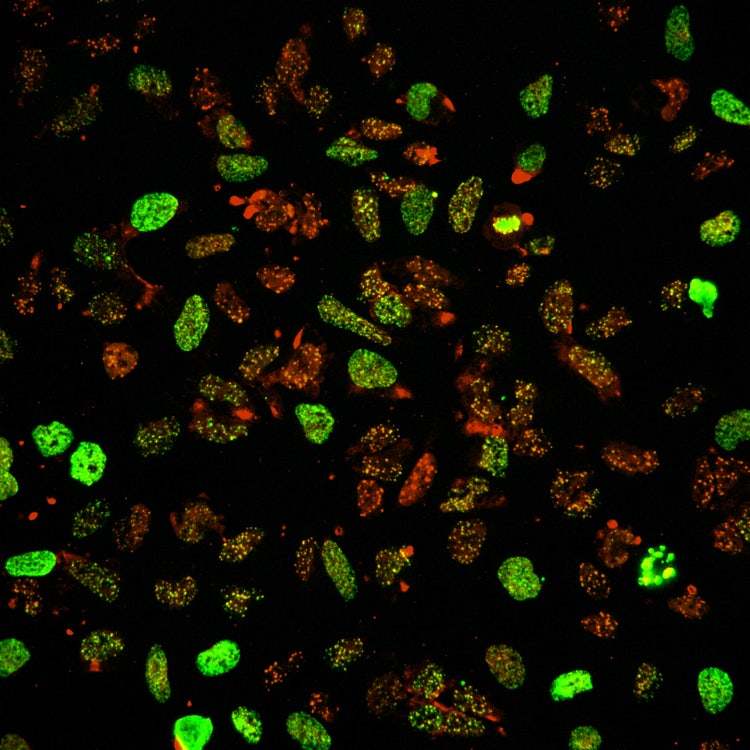 Solution d’imagerie haut contenu Micro Confocal