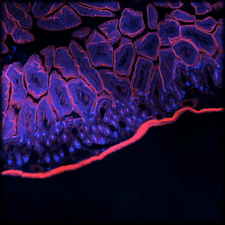 Système d’imagerie Micro Confocal