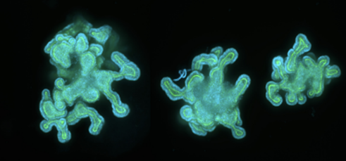 Image of Intestinal Organoids