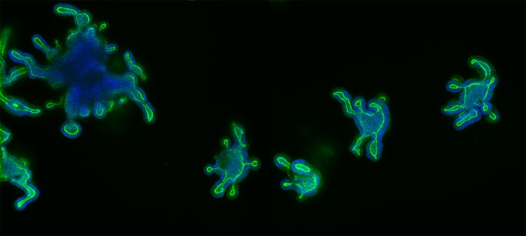 Les organoïdes intestinaux sont des modèles tissulaires 3D qui reproduisent les structures de la lumière intestinale et...