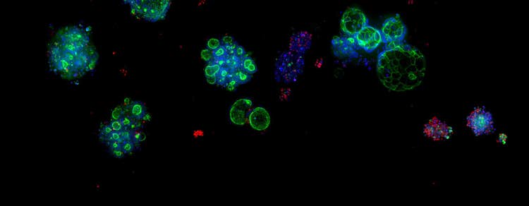 Assay-ready patient-derived organoids (PDOs)