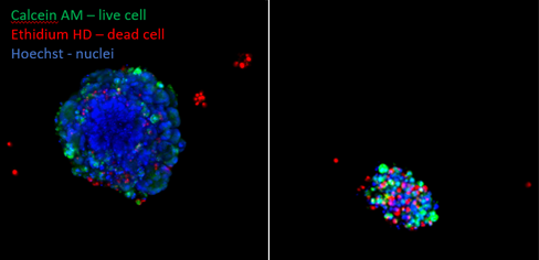 Organoïdes de cancer colorectal