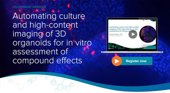 Automatisation de la culture et de l’imagerie haut contenu des organoïdes 3D 