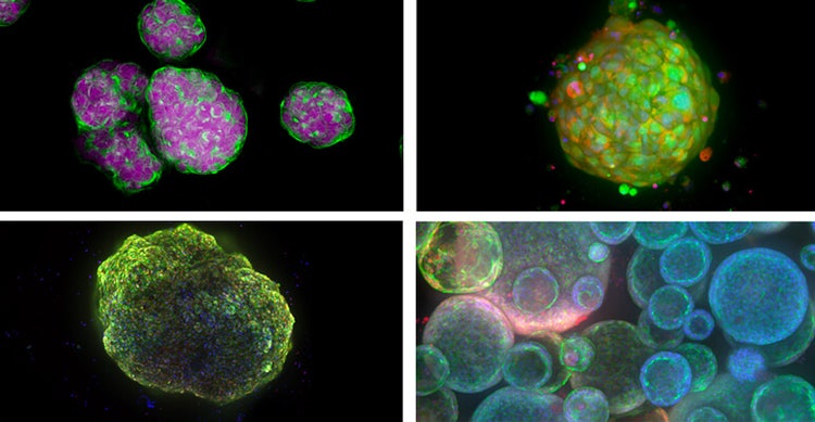 Exemples de modèles cellulaires 3D  : sphéroïdes, organoïdes dérivés de patients, cardiooïdes (organoïdes cardiaques) et organoïdes pulmonaires