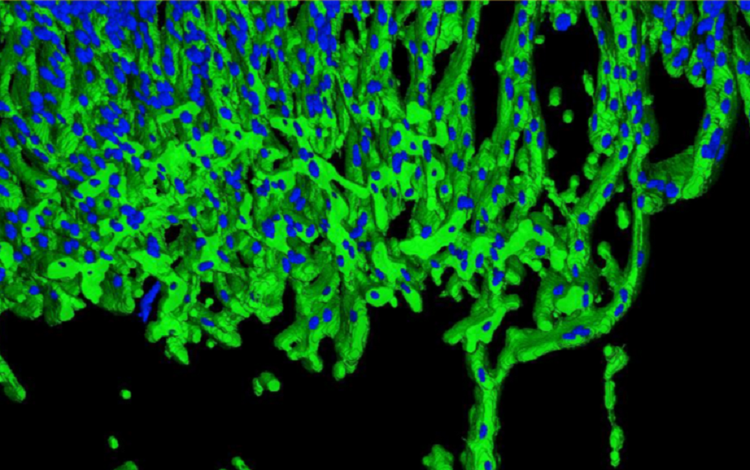 Analyse 3D des germes angiogéniques (vert) et des noyaux (bleu) avec MetaXpress