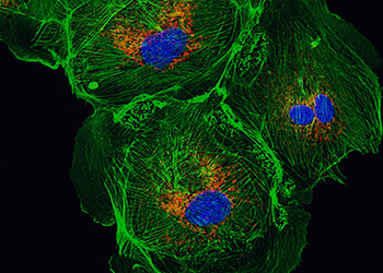 Découverte et optimisation d’un immunogène