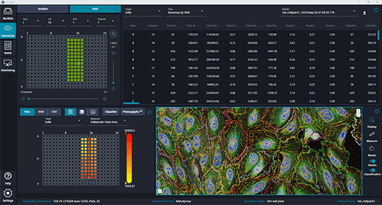 Logiciel d’analyse d’images IN Carta