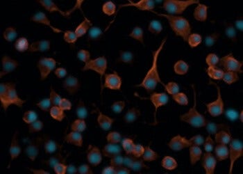 Fonction d’analyse d’excroissance des neurites