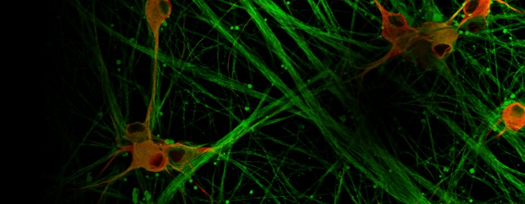 Imagerie des cellules souches