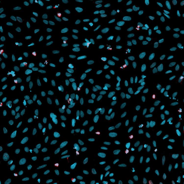 Superposition d’altérations de l’ADN dans des cellules U2OS avec le système ImageXpress Nano