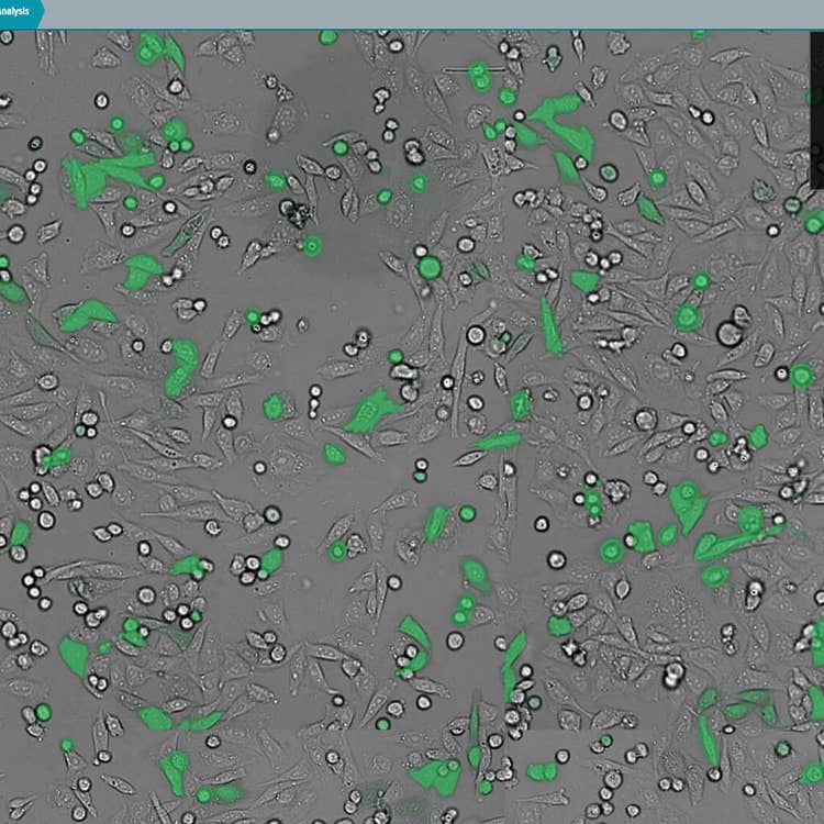 Superposition de lumière transmise et GFP avec le logiciel CellReporterXpress sur le système ImageXpress Nano