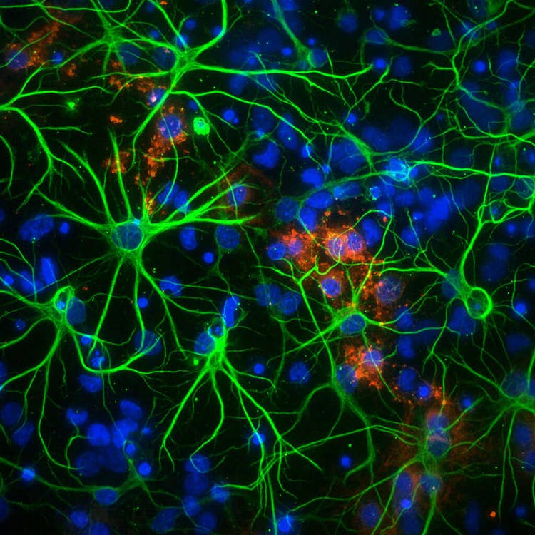Neurones dans 1536 puits à 60X PA avec le système ImageXpress Micro Confocal