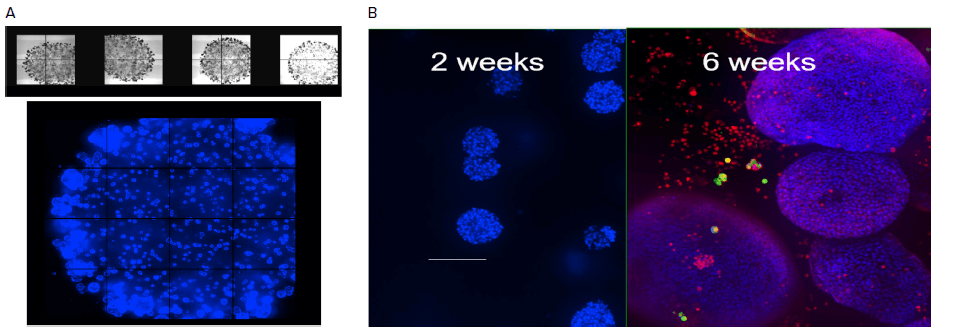Organoids in Matrigel dome four weeks in culture and Comparison of organoid size
