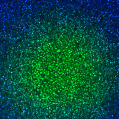Pénétration dans les tissus profonds avec le disque confocal