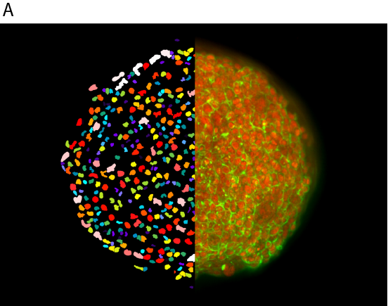 Imagerie 3D de sphéroïdes cancéreux