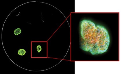 Réduisez le temps d’acquisition des images