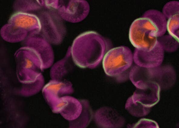 Sans Digital Confocal
