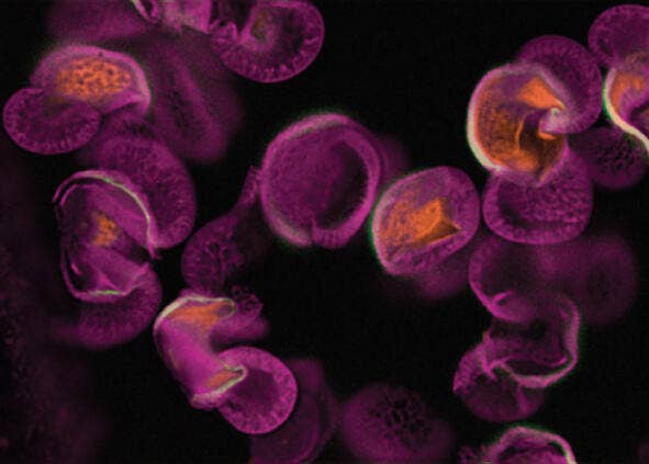 Avec Digital Confocal